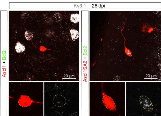 Anti-Kv3.1B K+ Channel Antibody - Image 2