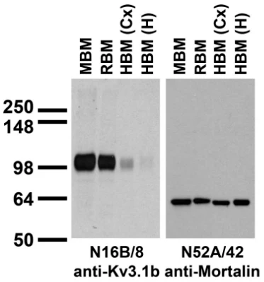 Anti-Kv3.1B K+ Channel Antibody - Image 5