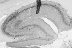 Anti-Kv3.2 Potassium Channel Antibody - Image 2
