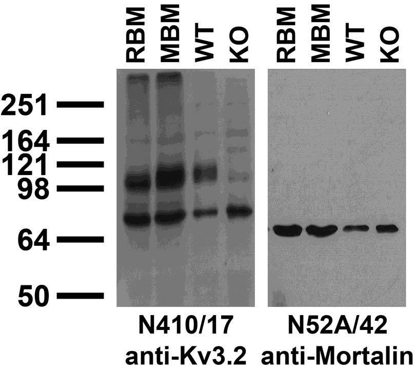 Anti-Kv3.2 Potassium Channel Antibody - Image 3