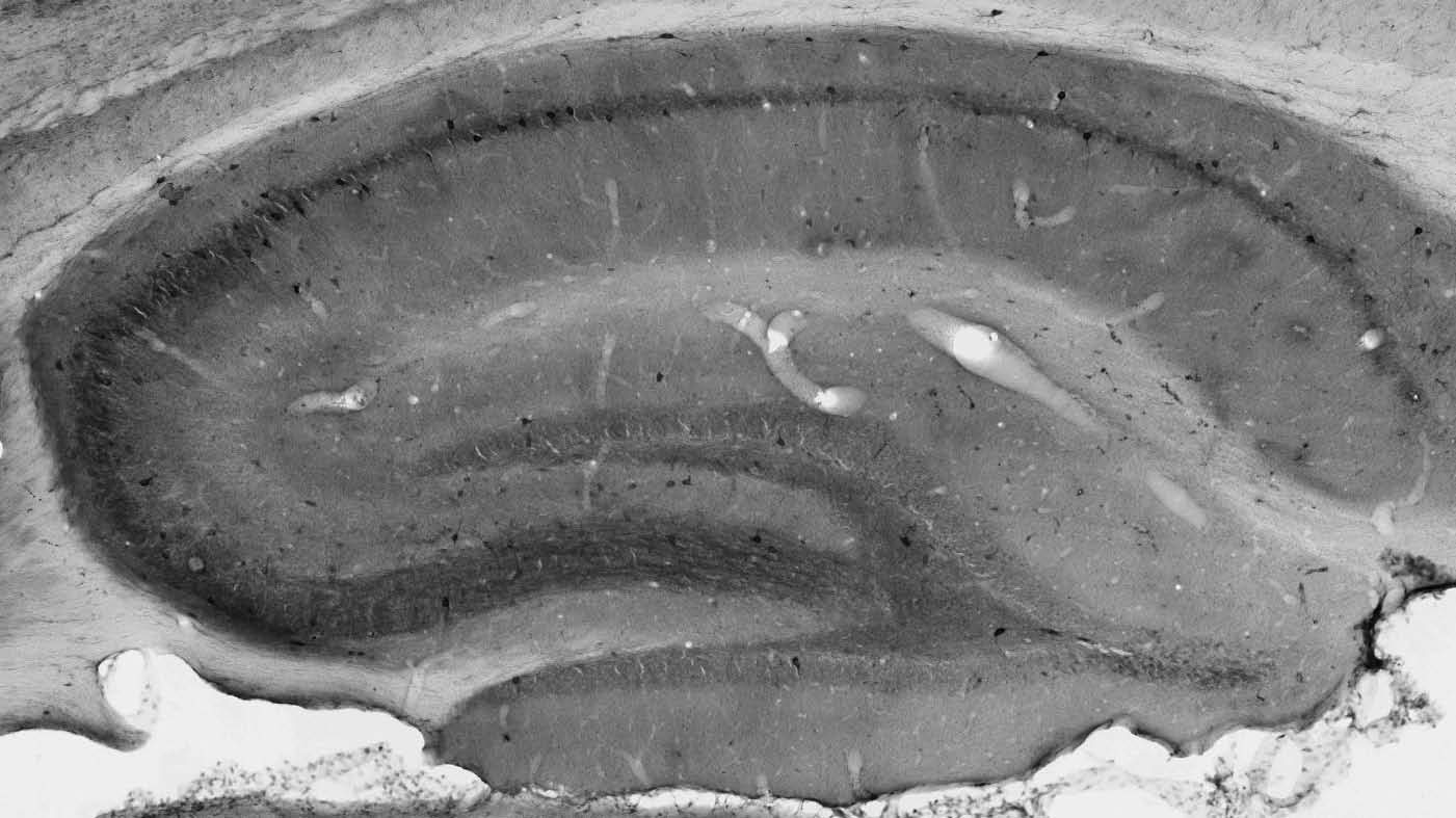 Anti-Kv3.3 Potassium Channel Antibody - Image 2