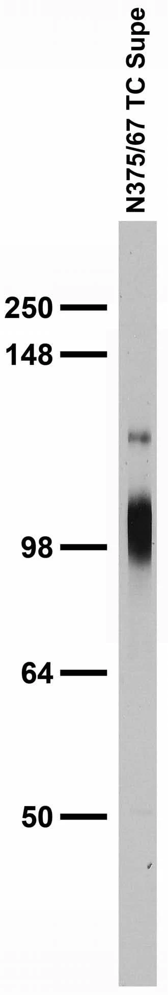 Anti-Kv3.3 Potassium Channel Antibody - Image 4