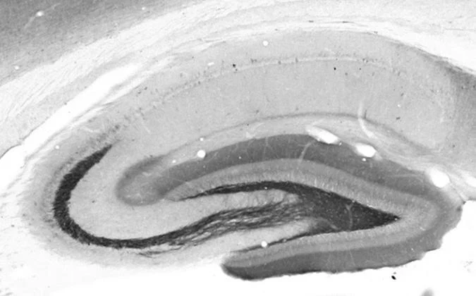 Anti-Kv3.4 K+ Channel Antibody - Image 2