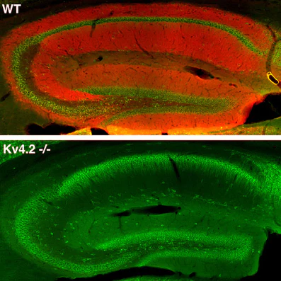 Anti-Kv4.2 K+ Channel Antibody