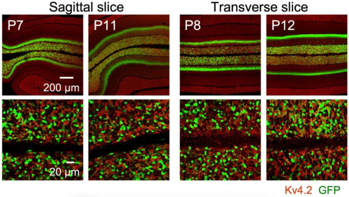 Anti-Kv4.2 K+ Channel Antibody - Image 3