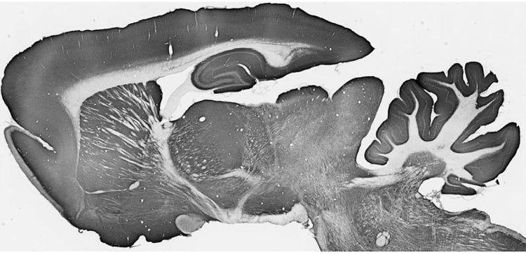 Anti-Kv4.2 K+ Channel Antibody - Image 4