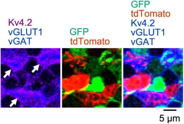 Anti-Kv4.2 K+ Channel Antibody - Image 5
