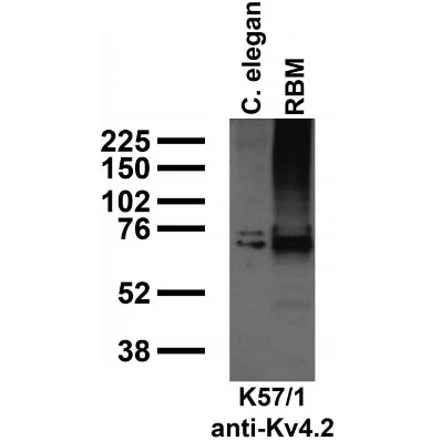 Anti-Kv4.2 K+ Channel Antibody - Image 6