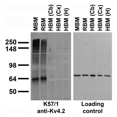 Anti-Kv4.2 K+ Channel Antibody - Image 7
