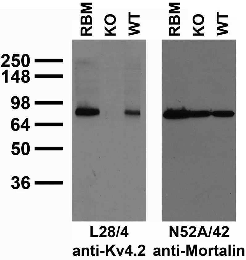 Anti-Kv4.2 Potassium Channel Antibody - Image 2