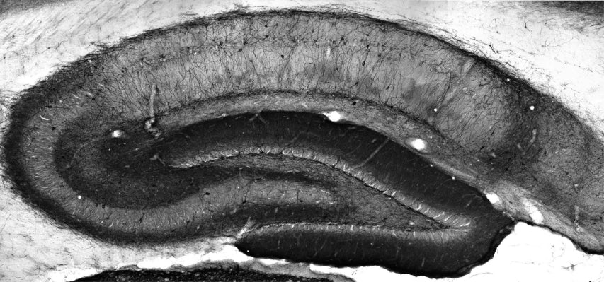 Anti-Kv4.3 K+ Channel Antibody - Image 2