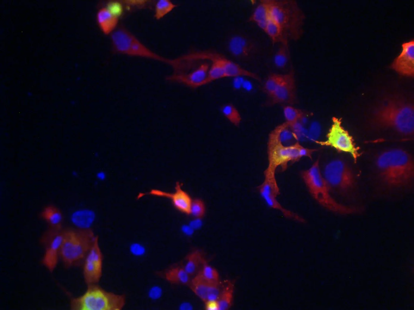 Anti-Kv6.1 Antibody