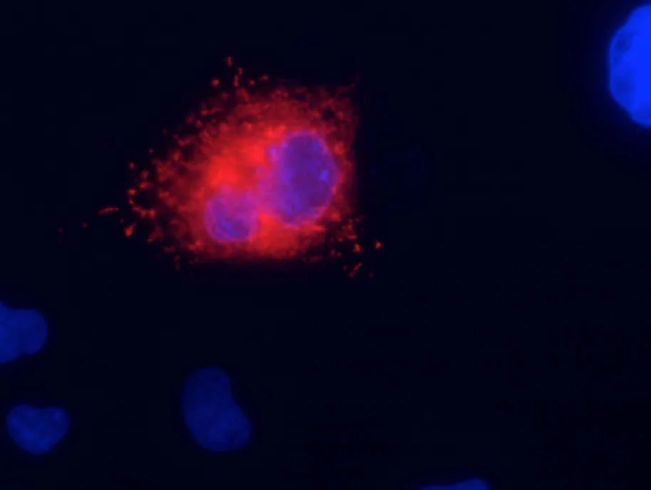Anti-Kv7.1/KCNQ1 K+ Channel Antibody