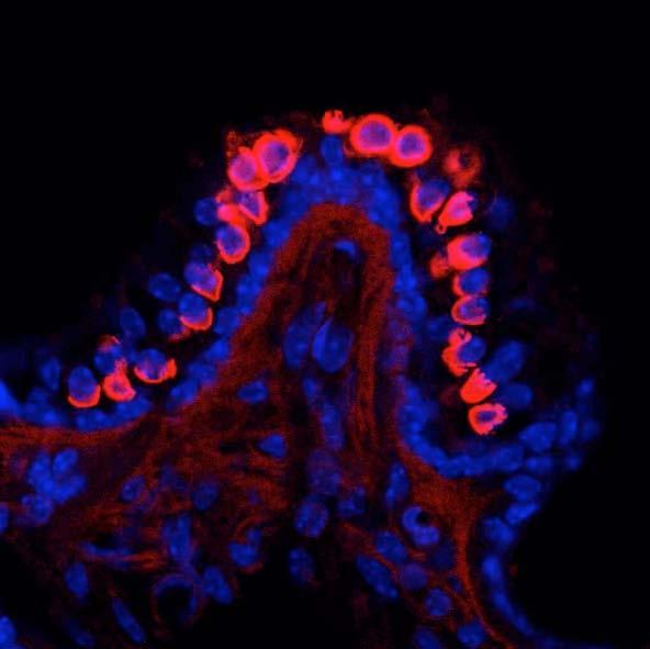 Anti-Kv7.4/KCNQ4 K+ Channel Antibody