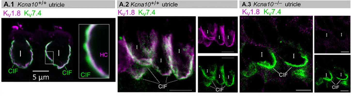 Anti-Kv7.4/KCNQ4 K+ Channel Antibody - Image 5