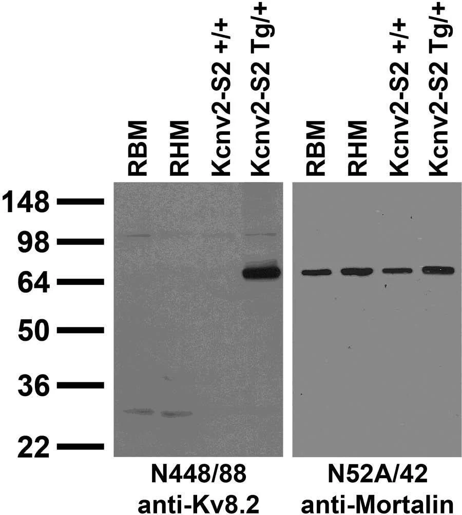 Anti-Kv8.2 Potassium Channel Antibody