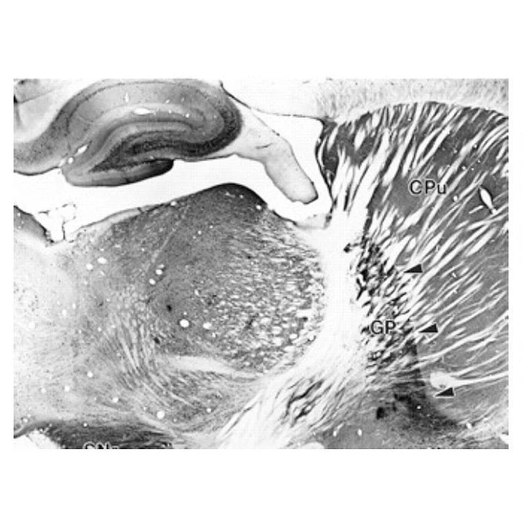 Anti-Kvbeta1.1 K+ Channel Antibody - Image 3