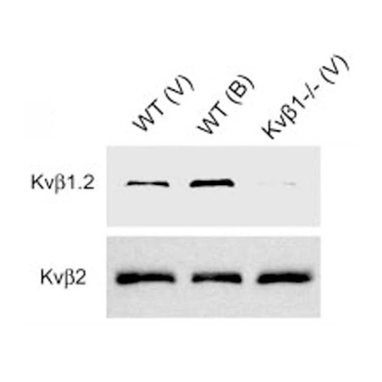 Anti-Kvbeta1.2 K+ Channel Antibody