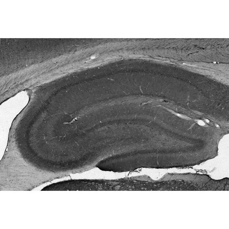 Anti-Kvbeta1.2 K+ Channel Antibody - Image 2