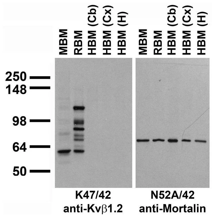 Anti-Kvbeta1.2 K+ Channel Antibody - Image 4