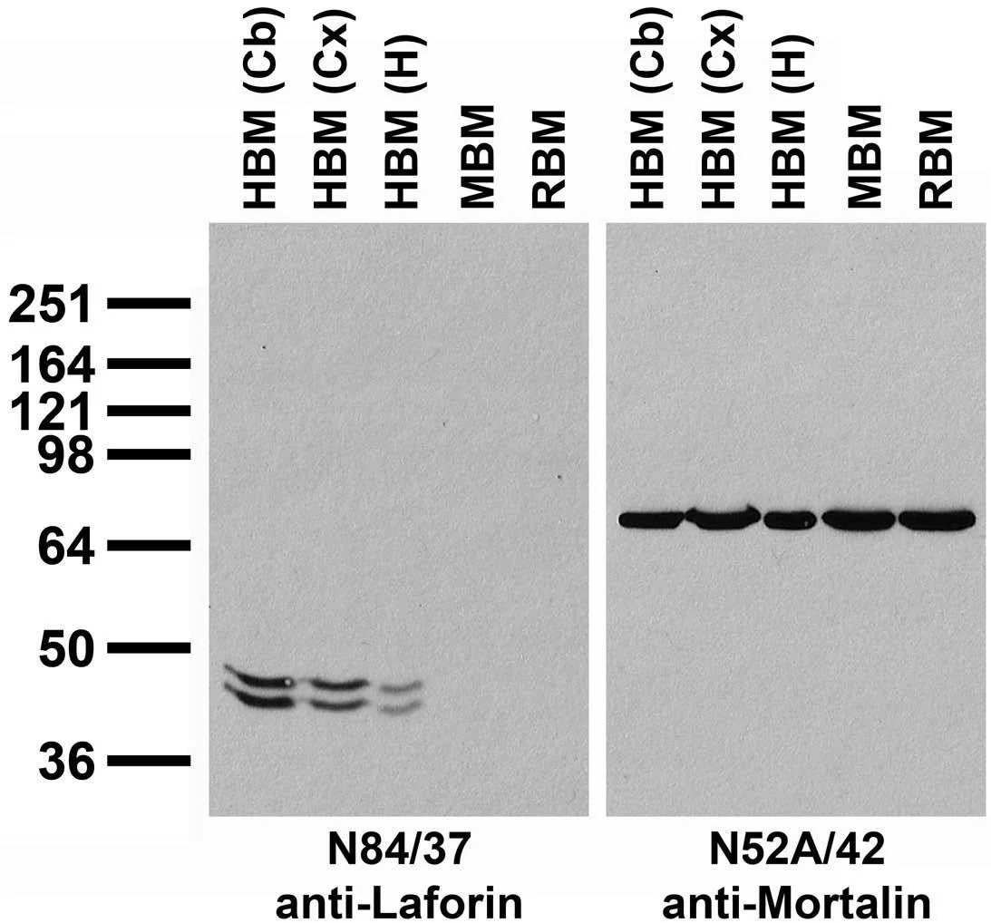 Anti-Laforin Antibody
