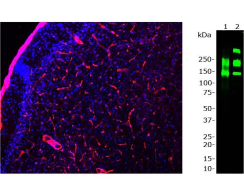 Anti-Laminin-111 Antibody