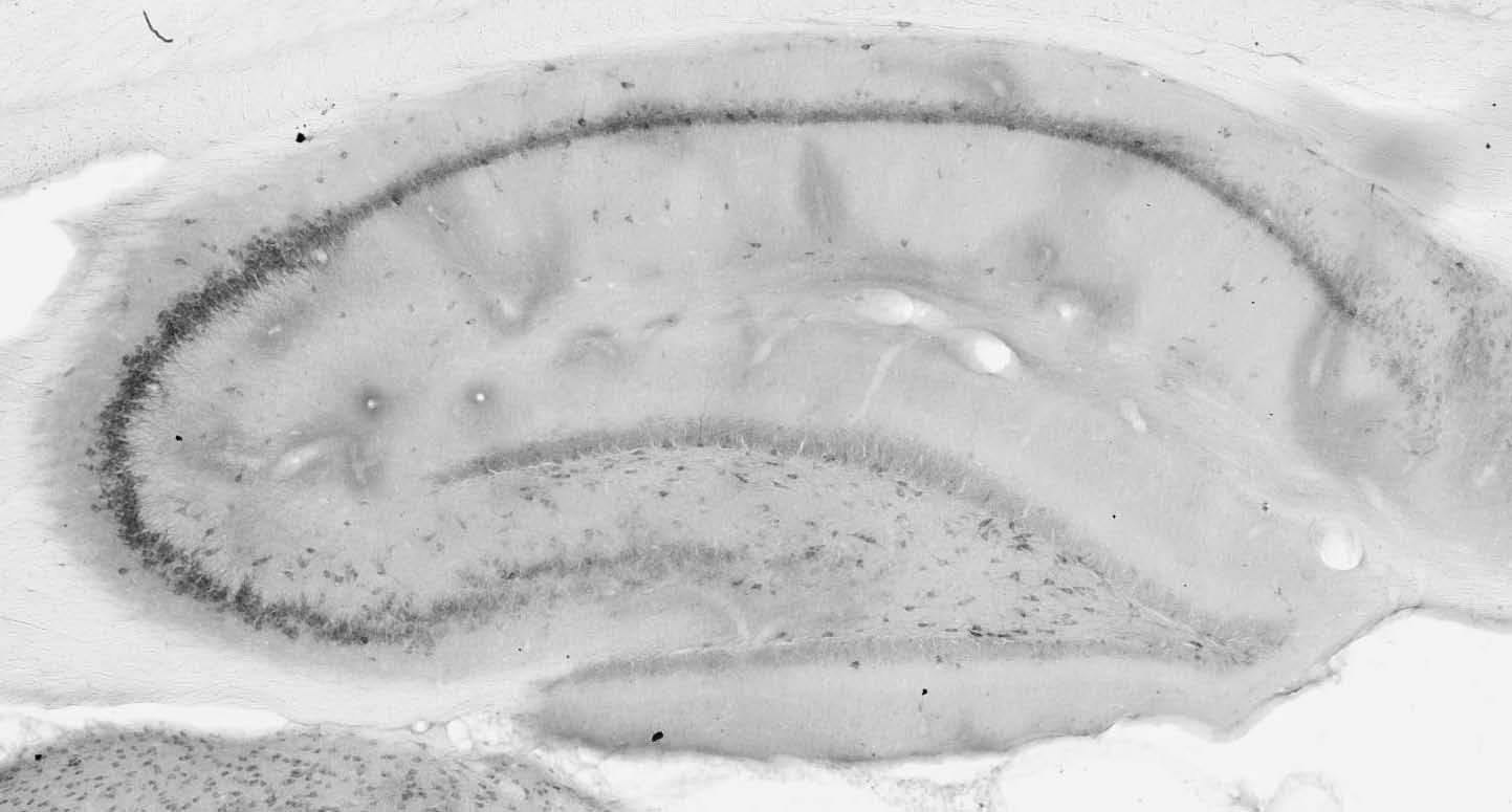 Anti-Lgi1 Antibody - Image 2