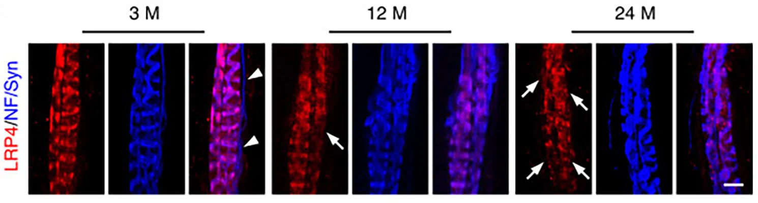 Anti-LRP4 (Extracellular) Antibody - Image 2