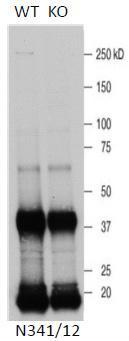 Anti-LRRK1 Antibody - Image 2