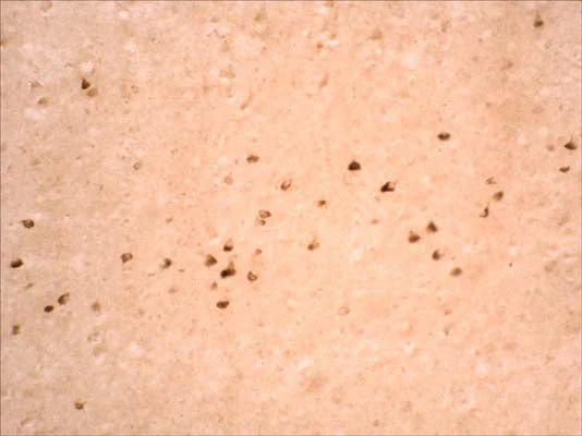 Anti-LRRK2 Antibody