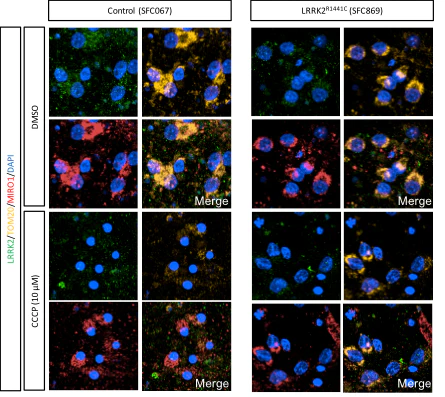 Anti-LRRK2/Dardarin, C-Terminus Antibody