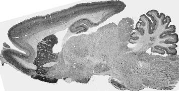 Anti-LRRK2/Dardarin, C-Terminus Antibody - Image 2