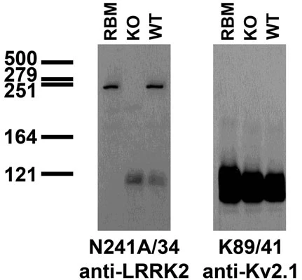 Anti-LRRK2/Dardarin, C-Terminus Antibody - Image 3