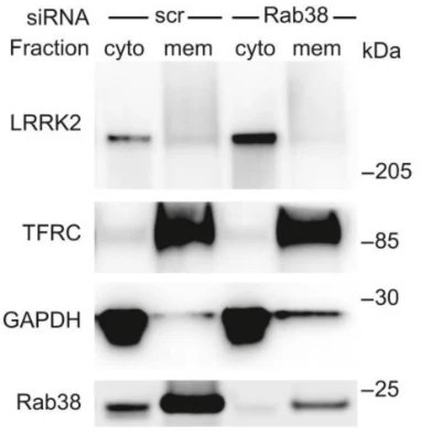 Anti-LRRK2/Dardarin, C-Terminus Antibody - Image 7