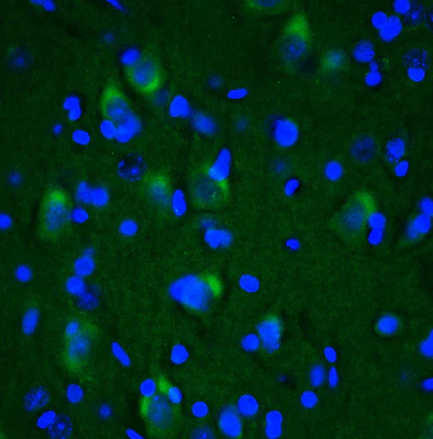 Anti-LRRK2/Dardarin, C-Terminus Recombinant Chicken Chimeric mAb