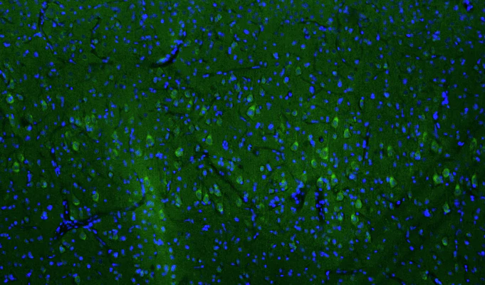 Anti-LRRK2/Dardarin, C-Terminus Recombinant Chicken Chimeric mAb - Image 2