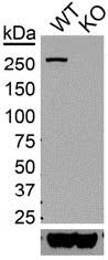 Anti-LRRK2/Dardarin, N3 (Non-Mouse-Reactive) Antibody - Image 2