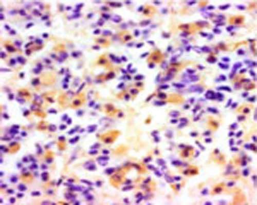 Anti-Luteinizing hormone subunit beta (LH-B) Antibody