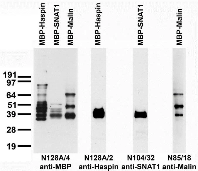 Anti-Maltose Binding Protein (MBP) Antibody