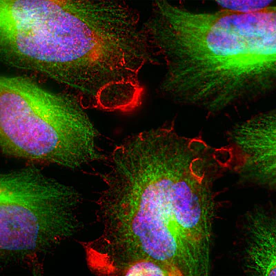 Anti-MARCKS Antibody
