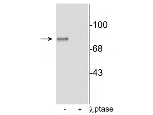 Anti-MARCKS (Ser152,156) Antibody