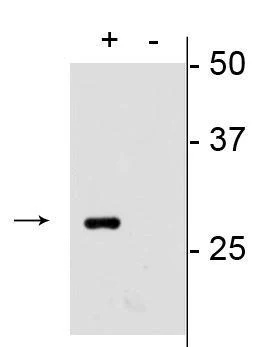 Anti-mCherry Antibody - Image 2