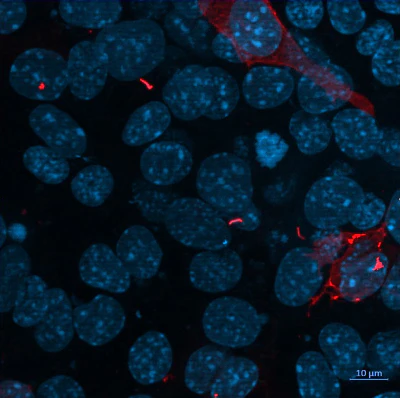 Anti-mCherry Antibody - Image 2