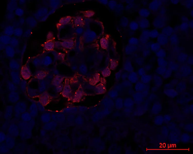 Anti-mCherry Antibody - Image 6