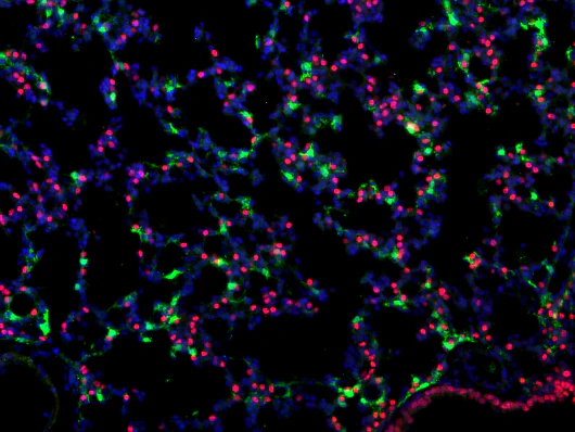 Anti-mCherry Antibody - Image 7