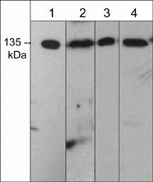 Anti-mDia2 (C-terminal region) Antibody