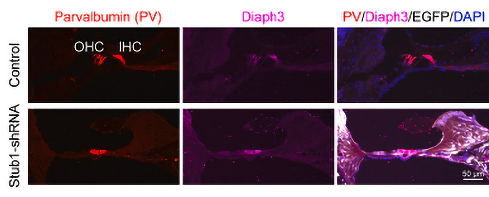 Anti-mDia2 (C-terminal region) Antibody - Image 2