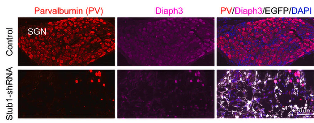 Anti-mDia2 (C-terminal region) Antibody - Image 3