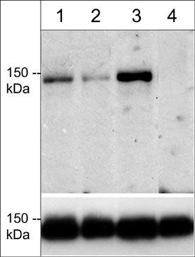Anti-mDia2 (Thr-1061), Phosphospecific Antibody