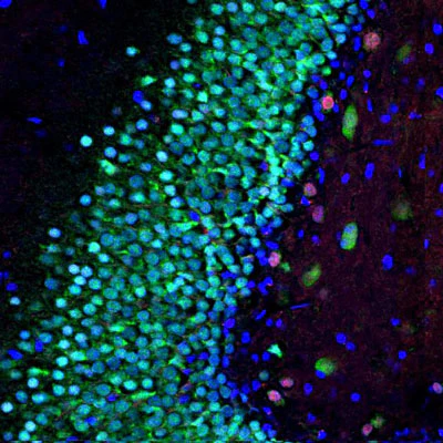 Anti-MeCP2 Antibody - Image 3